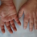 Cómo controlar el crecimiento excesivo en los niños